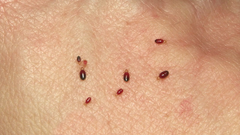 bed bugs on skin
