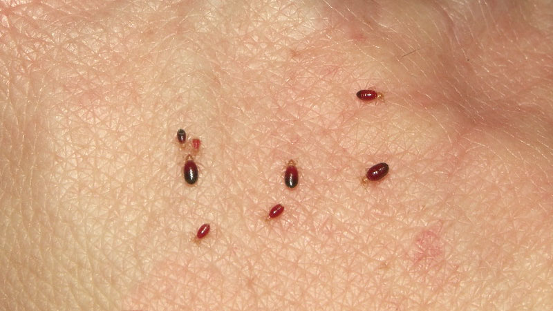 9 Bugs That Look Like Black Sesame Seeds (or Poppy Seeds)