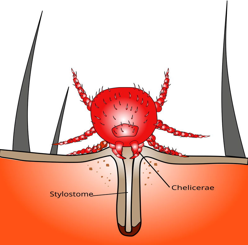 chigger bite